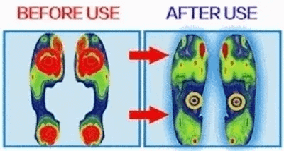 🔥Best Seller-Last Day Sale 50% OFF - Women's Soft-Sole Orthopedic Sandals | Ultra-Comfortable Open-Toe Design